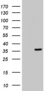 ENKUR Antibody in Western Blot (WB)