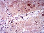 NSE Antibody in Immunohistochemistry (Paraffin) (IHC (P))