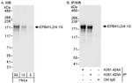 EPB41L2/4.1G Antibody in Western Blot (WB)