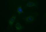 EPCAM Antibody in Immunocytochemistry (ICC/IF)