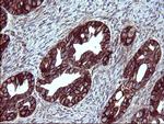 EPCAM Antibody in Immunohistochemistry (Paraffin) (IHC (P))