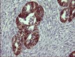 EPCAM Antibody in Immunohistochemistry (Paraffin) (IHC (P))