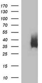 EPCAM Antibody in Western Blot (WB)