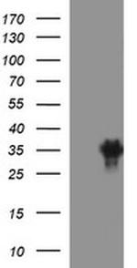 EPCAM Antibody in Western Blot (WB)