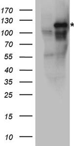 EPHA3 Antibody in Western Blot (WB)