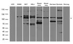 EPHA3 Antibody in Western Blot (WB)