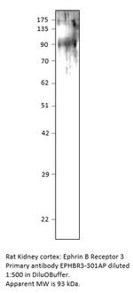 Ephrin Receptor B3 Antibody in Western Blot (WB)