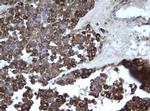 EPHX1 Antibody in Immunohistochemistry (Paraffin) (IHC (P))