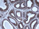 EPHX1 Antibody in Immunohistochemistry (Paraffin) (IHC (P))