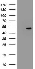 EPHX1 Antibody in Western Blot (WB)