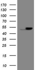 EPHX1 Antibody in Western Blot (WB)