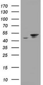 EPHX1 Antibody in Western Blot (WB)