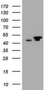 EPHX1 Antibody in Western Blot (WB)