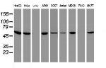 EPHX1 Antibody in Western Blot (WB)