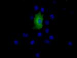 EPHX2 Antibody in Immunocytochemistry (ICC/IF)