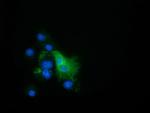 EPHX2 Antibody in Immunocytochemistry (ICC/IF)