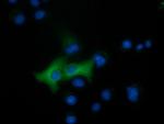 EPHX2 Antibody in Immunocytochemistry (ICC/IF)