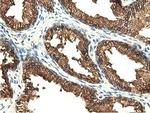 EPHX2 Antibody in Immunohistochemistry (Paraffin) (IHC (P))