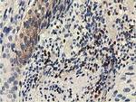 EPHX2 Antibody in Immunohistochemistry (Paraffin) (IHC (P))