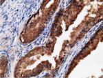 EPHX2 Antibody in Immunohistochemistry (Paraffin) (IHC (P))