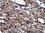 EPHX2 Antibody in Immunohistochemistry (Paraffin) (IHC (P))