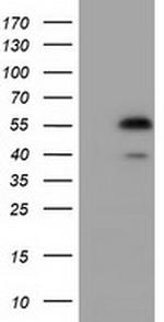 EPHX2 Antibody in Western Blot (WB)