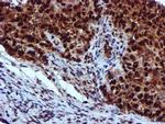 EPM2AIP1 Antibody in Immunohistochemistry (Paraffin) (IHC (P))