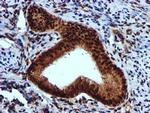 EPM2AIP1 Antibody in Immunohistochemistry (Paraffin) (IHC (P))