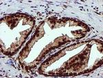 EPM2AIP1 Antibody in Immunohistochemistry (Paraffin) (IHC (P))