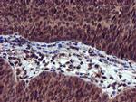 EPM2AIP1 Antibody in Immunohistochemistry (Paraffin) (IHC (P))