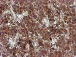 EPM2AIP1 Antibody in Immunohistochemistry (Paraffin) (IHC (P))