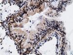 EPM2AIP1 Antibody in Immunohistochemistry (Paraffin) (IHC (P))