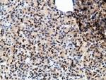 EPM2AIP1 Antibody in Immunohistochemistry (Paraffin) (IHC (P))