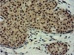 EPM2AIP1 Antibody in Immunohistochemistry (Paraffin) (IHC (P))