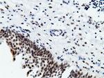 EPM2AIP1 Antibody in Immunohistochemistry (Paraffin) (IHC (P))