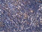 EPM2AIP1 Antibody in Immunohistochemistry (Paraffin) (IHC (P))