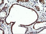 EPM2AIP1 Antibody in Immunohistochemistry (Paraffin) (IHC (P))