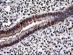 EPM2AIP1 Antibody in Immunohistochemistry (Paraffin) (IHC (P))