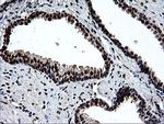 EPM2AIP1 Antibody in Immunohistochemistry (Paraffin) (IHC (P))