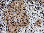 EPM2AIP1 Antibody in Immunohistochemistry (Paraffin) (IHC (P))