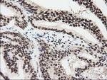 EPM2AIP1 Antibody in Immunohistochemistry (Paraffin) (IHC (P))