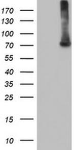 EPM2AIP1 Antibody in Western Blot (WB)