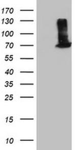 EPM2AIP1 Antibody in Western Blot (WB)