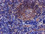 EPN2 Antibody in Immunohistochemistry (Paraffin) (IHC (P))