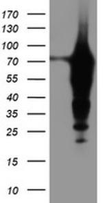 EPN2 Antibody in Western Blot (WB)