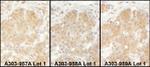 EPRS Antibody in Immunohistochemistry (IHC)