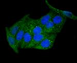 DKK1 Antibody in Immunocytochemistry (ICC/IF)