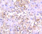 DKK1 Antibody in Immunohistochemistry (Paraffin) (IHC (P))