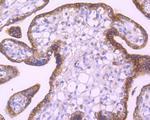 EGFR Antibody in Immunohistochemistry (Paraffin) (IHC (P))