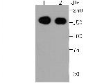 EGFR Antibody in Western Blot (WB)